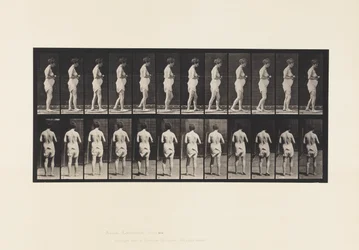 Plate 542. Multiple Cerebro-Spinal Sclerosis - Walking