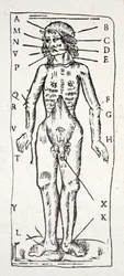 A Body Which Has Been Under the Scalpel, with Veins Labelled