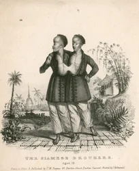 Chang and Eng, the Siamese Youths, aged 18