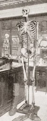 The Skeletons of Charles Byrne