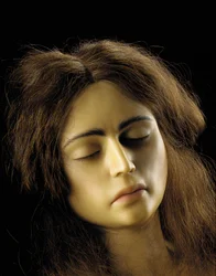 Anatomical model of an ovarian pregnancy (detail)