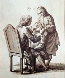 A Doctor operating on a cataract patient (illustration from the Medical Encyclopedia by Denis Diderot and Jean le Rond d