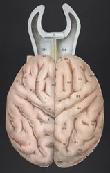 A section of the brain, from 