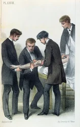 Amputating an arm, from a medical manual by Jean-Baptiste-Leon Dubreuil