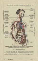 Ideal figure, showing the progression of a virus in the body and the successive accidents of a diathesis with complete evolution, according to the author