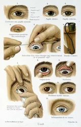 Medicine: the eye