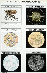 Microscopes: A Chip, Diatoms, Blood, Coal, Tuberculosis, Metals