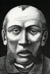 Patient with cerebral softening (engraving, 1888)