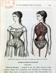 The Harmful Effects of the Corset, illustration from La Vie Normale et la Santé by Dr Jules Rengade (b. 1841), c. 1880