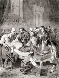 The First Public Demonstration of the Use of Inhaled Ether as a Surgical Anaesthetic in 1846 by William Thomas Green Morton