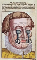 Treating an Eye Condition, from Ophthalmodouleia by Georg Bartisch, published in Dresden in 1583