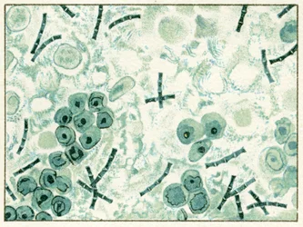 Sample of Anthrax Bacteria in blood