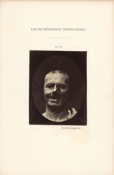 Electro-Physiological Photography, Figure 53