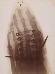 The Foot Through the Shoe