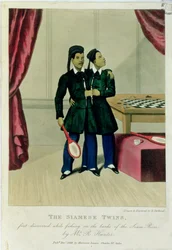 The Siamese Twins, First Discovered While Fishing on the Banks of the Siam River by Mr R. Hunter, 1829