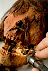 Dr. John Varano examines the teeth of the mummy