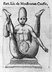 Human monster: a creature with a huge skull, with apparent bowels. Engraving from 