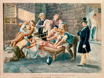 Patriot and member of the Carboneria (Carbonarism) Pietro Maroncelli (1795-1846) had his leg amputated during his imprisonment in the penitentiary of the fortress of Spielberg in Moravia. Prints of the 19th century, Museo del Risorgimento, Milan