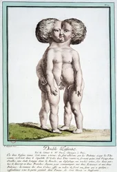 Siamese Children - in 