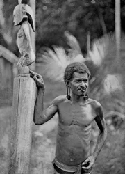 Malformation of the Ears, Solomon Islands, 1920