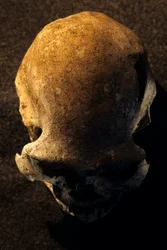 Homo erectus skull, toothless, Dmanisi, Georgia Homo Erectus site