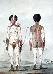 “Little Black Girl Born in Lille, St. Lucia”, c.1795