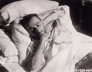 Egon Schiele on His Deathbed