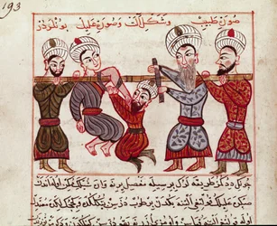 Orthopedic Intervention. Miniature from a Turkish Medicine Book by Charaf-ed-din (1466)