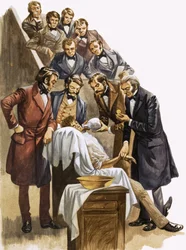 Doctors Using Nitrous Oxide (Laughing Gas) as an Anaesthetic