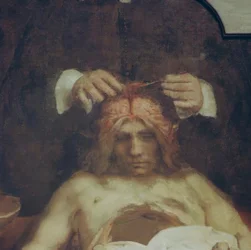 The Anatomy Lesson of Dr. Johan Deijman