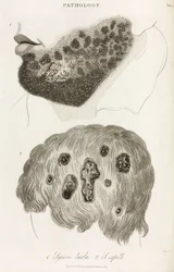 Skin Diseases