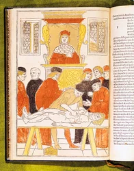 Anatomy Lecture at Padua, Italy