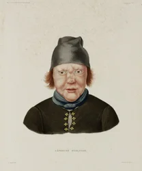 Diseases, Leprosy Female Leper, Iceland, early 19th century