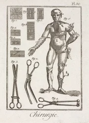 Early-Modern Bandaging a Human Figure