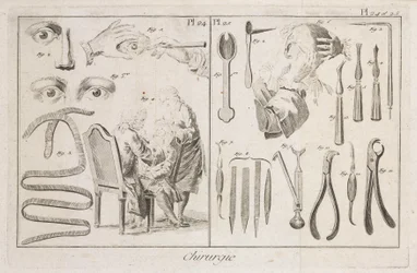 Equipment, Early-Modern Eye Surgery and Surgical Instruments