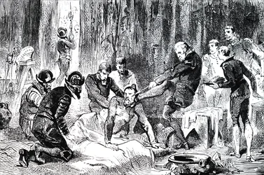 Ambroise Pare Removing a Lance from the Face of the Duc de Guise