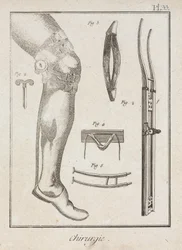 Early-Modern Surgical Supports