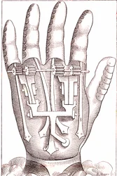 Artificial Hand Prosthesis by the French Surgeon Anatomist Ambroise Paré