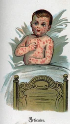 Children