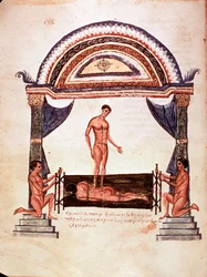 Medicine: Reduction of a Dislocated Spine - Patient is Fixed on a Wooden Board, One of the Therapists Stands on His Back
