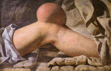 A Swelling in the Knee