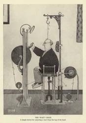 The wart chair, a simple device for removing a wart from the top of the head