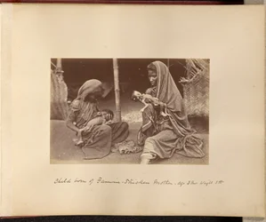 Child Born of Famine-Stricken Mother - Age: 3 months, Weight: 3 lbs.